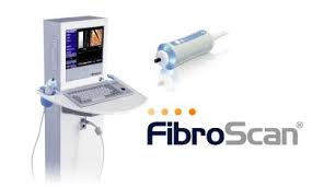 Fibroscan